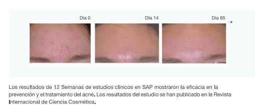 Resultados de 12 semanas de uso de AcneVit contra el acné
