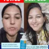 Testimonio del gel de limpieza para pieles mixtas a grasas dermaskin, antiacne