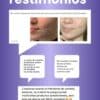 Testimonios de la crema de centella asiatica, anti acne