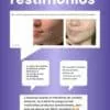 Testimonios de la crema de centella asiatica, anti acne