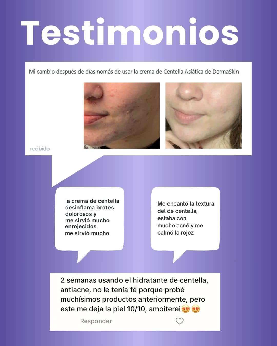Testimonios de la crema de centella asiatica, anti acne