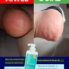antes y despues del suero corporal ultra hidratante dermaskin, hidrata la piel seca
