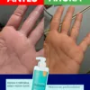 antes y despues del suero ultra hidratante dermaskin, hidrata la piel seca
