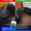 antes y despues del shampoo zerosebum, ayuda contra la caspa