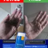 antes y despues del shampoo zerosebum, ayuda contra las caidas
