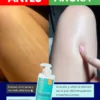 antes y despues de usar el suero ultra hidratante de dermaskin, hidrata la piel seca y foliculitis